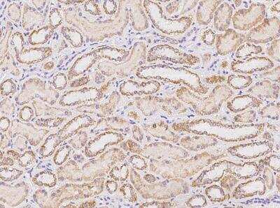 Immunohistochemistry-Paraffin: SLC38A11 Antibody [NBP3-06535]