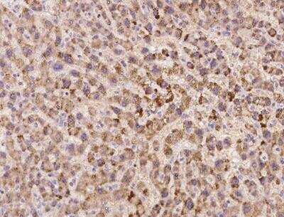 Immunohistochemistry-Paraffin: SLC38A11 Antibody [NBP3-06535]