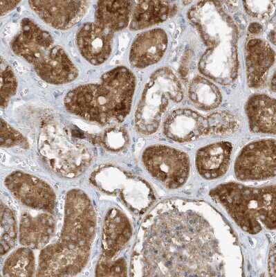 Immunohistochemistry-Paraffin: SLC38A2 Antibody [NBP1-88872]