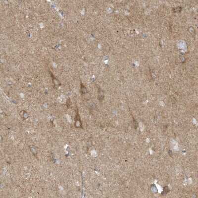 Immunohistochemistry-Paraffin: SLC38A2 Antibody [NBP1-88872]