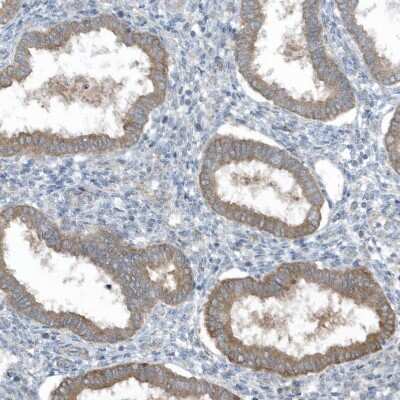 Immunohistochemistry-Paraffin: SLC38A2 Antibody [NBP1-88872]