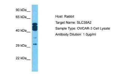 Western Blot: SLC38A2 Antibody [NBP2-83554]