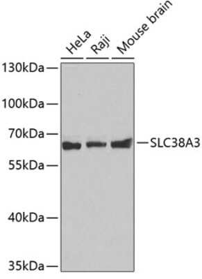 Western Blot: SLC38A3 AntibodyAzide and BSA Free [NBP2-93143]