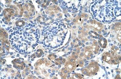 Immunohistochemistry-Paraffin: SLC38A4 Antibody [NBP1-55228]