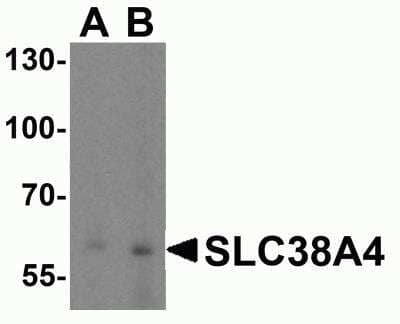 Western Blot: SLC38A4 AntibodyBSA Free [NBP2-81807]