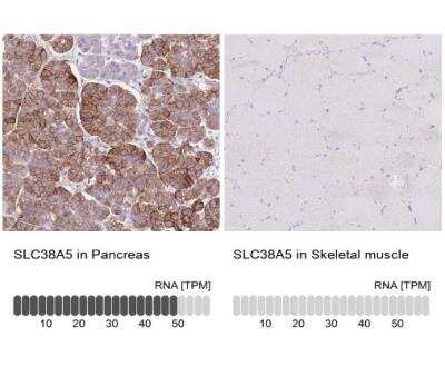 Immunohistochemistry-Paraffin: SLC38A5 Antibody [NBP1-92402]