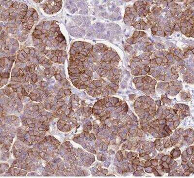 Immunohistochemistry-Paraffin: SLC38A5 Antibody [NBP1-92402]