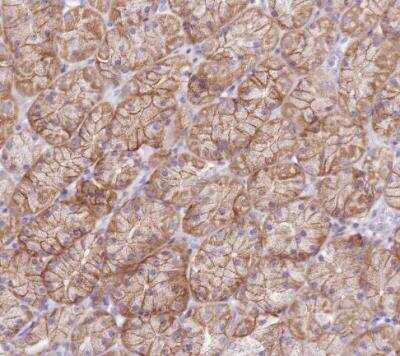Immunohistochemistry-Paraffin: SLC38A5 Antibody [NBP1-92402]