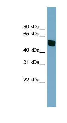 Western Blot: SLC38A5 Antibody [NBP1-59895]