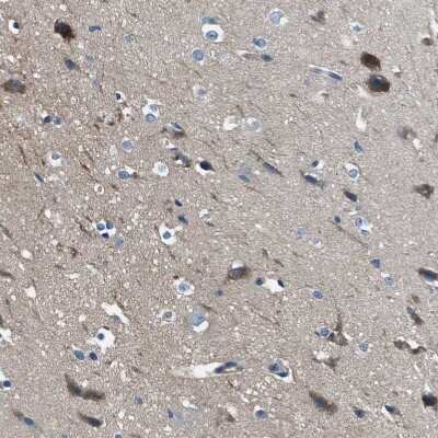 Immunohistochemistry-Paraffin: SLC38A6 Antibody [NBP1-81010]