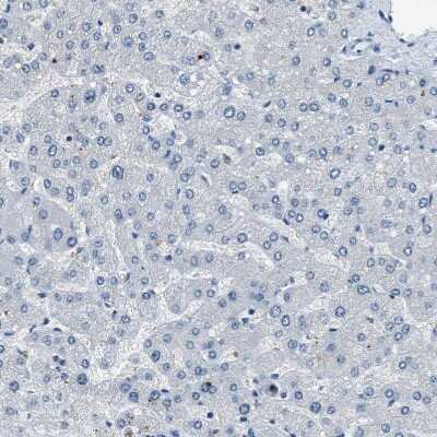 Immunohistochemistry-Paraffin: SLC38A6 Antibody [NBP1-81010]