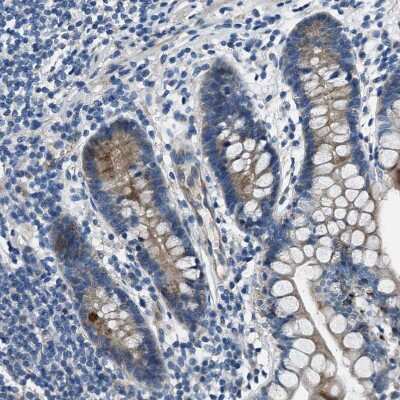 Immunohistochemistry-Paraffin: SLC38A6 Antibody [NBP1-81010]