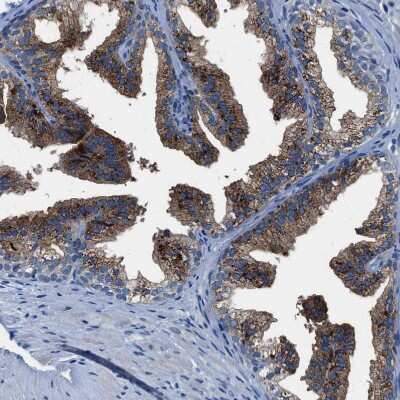 Immunohistochemistry-Paraffin: SLC38A6 Antibody [NBP1-81010]