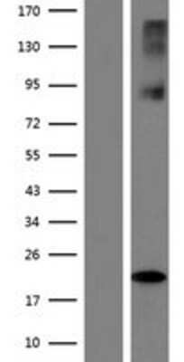 Western Blot: SLC38A6 Overexpression Lysate [NBP2-10258]