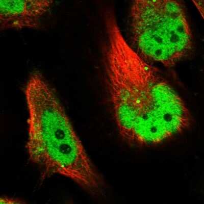 Immunocytochemistry/ Immunofluorescence: SLC38A9 Antibody [NBP1-92403]