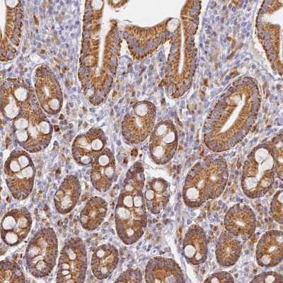 Immunohistochemistry-Paraffin: SLC38A9 Antibody [NBP1-92403]