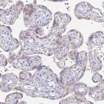 Immunohistochemistry-Paraffin: SLC38A9 Antibody [NBP1-92403]