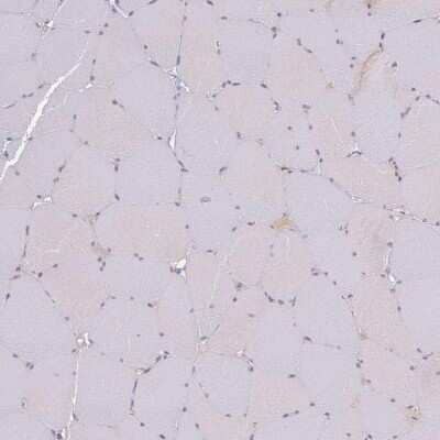 Immunohistochemistry-Paraffin: SLC38A9 Antibody [NBP1-92403]