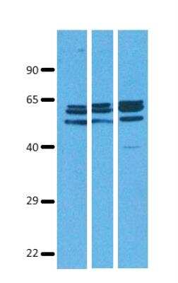 Western Blot: SLC38A9 Antibody [NBP1-69235]