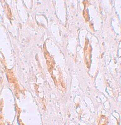 Immunohistochemistry: SLC39A1 Antibody - BSA Free [NBP1-76498]