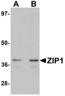 Western Blot: SLC39A1 AntibodyBSA Free [NBP1-76498]