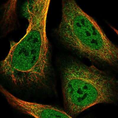 Immunocytochemistry/ Immunofluorescence: SLC39A10 Antibody [NBP2-38306]