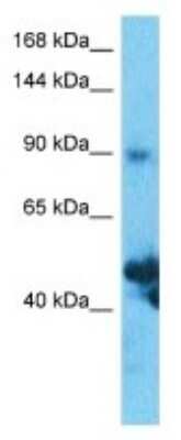 Western Blot: SLC39A10 Antibody [NBP3-10575]