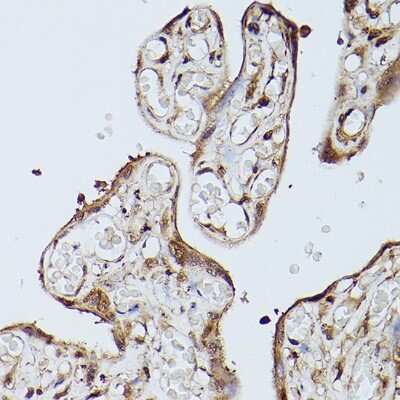 Immunohistochemistry-Paraffin: SLC39A11 Antibody - Azide and BSA Free [NBP3-16004]