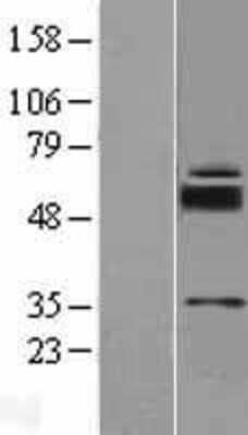 Western Blot: SLC39A11 Overexpression Lysate [NBL1-16141]