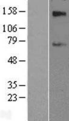 Western Blot: SLC39A12 Overexpression Lysate [NBL1-16142]