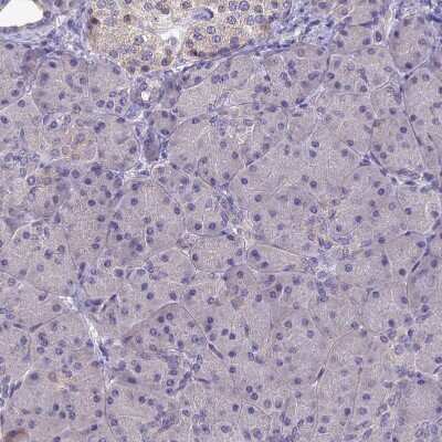 Immunohistochemistry-Paraffin: SLC39A13 Antibody [NBP1-92404]