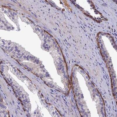 Immunohistochemistry-Paraffin: SLC39A13 Antibody [NBP1-92404]