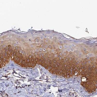 Immunohistochemistry-Paraffin: SLC39A13 Antibody [NBP1-92404]