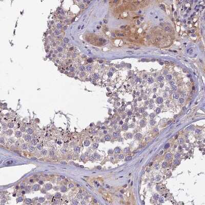 Immunohistochemistry-Paraffin: SLC39A13 Antibody [NBP1-92404]