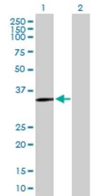 Western Blot: SLC39A13 Antibody [H00091252-B01P]