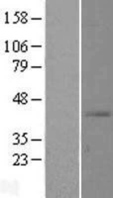 Western Blot: SLC39A13 Overexpression Lysate [NBL1-16143]