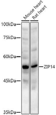 Western Blot: SLC39A14 AntibodyAzide and BSA Free [NBP2-93483]