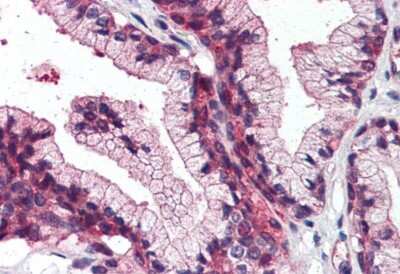 Immunohistochemistry-Paraffin: SLC39A14 Antibody - BSA Free [NBP3-06675]