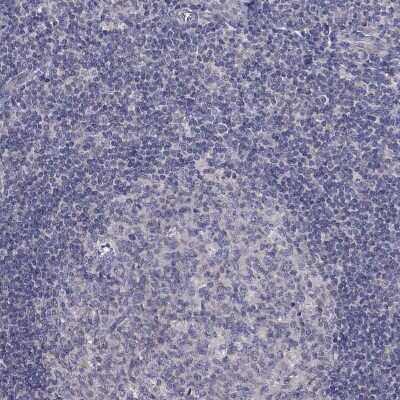 Immunohistochemistry-Paraffin: SLC39A14 Antibody [NBP3-17091]