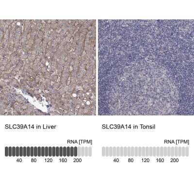 Immunohistochemistry-Paraffin: SLC39A14 Antibody [NBP3-17091]