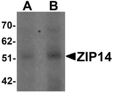 Western Blot: SLC39A14 AntibodyBSA Free [NBP1-76510]