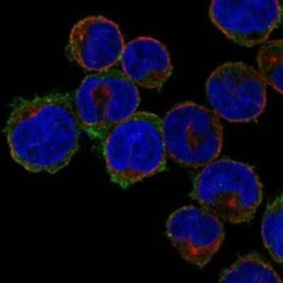 Immunocytochemistry/ Immunofluorescence: SLC39A2/ZIP2 Antibody [NBP3-17439]