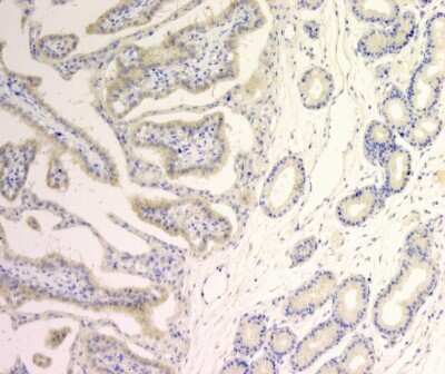 Immunohistochemistry: SLC39A2/ZIP2 Antibody - BSA Free [NBP1-76499]