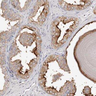 Immunohistochemistry-Paraffin: SLC39A2/ZIP2 Antibody [NBP1-86830]