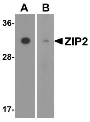 Western Blot: SLC39A2/ZIP2 AntibodyBSA Free [NBP1-76499]