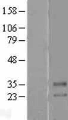 Western Blot: SLC39A2/ZIP2 Overexpression Lysate [NBL1-16145]