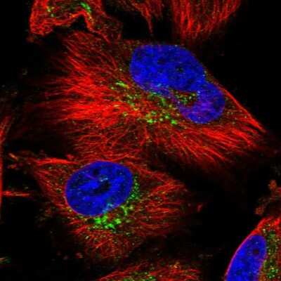 Immunocytochemistry/ Immunofluorescence: SLC39A3 Antibody [NBP1-86829]