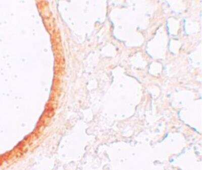 Immunohistochemistry: SLC39A3 Antibody - BSA Free [NBP1-76500]