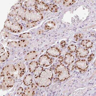 Immunohistochemistry-Paraffin: SLC39A3 Antibody [NBP2-46852]