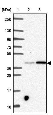 Western Blot: SLC39A3 Antibody [NBP2-46852]